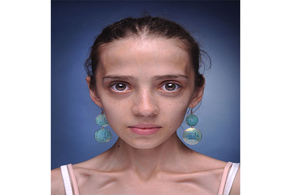 Il Collarbone Challenge o sfida della clavicola: la nuova social moda pericolosa